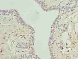 ARMT1 Antibody
