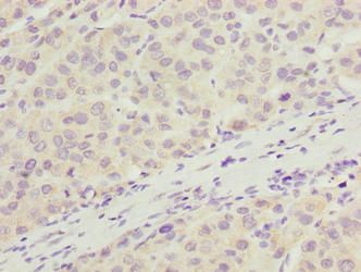 ARMT1 Antibody