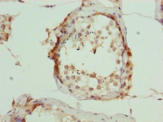 ARMT1 Antibody