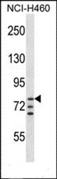 ARNT antibody