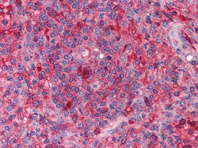 ARNTL Antibody