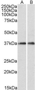 ARPC1A Antibody