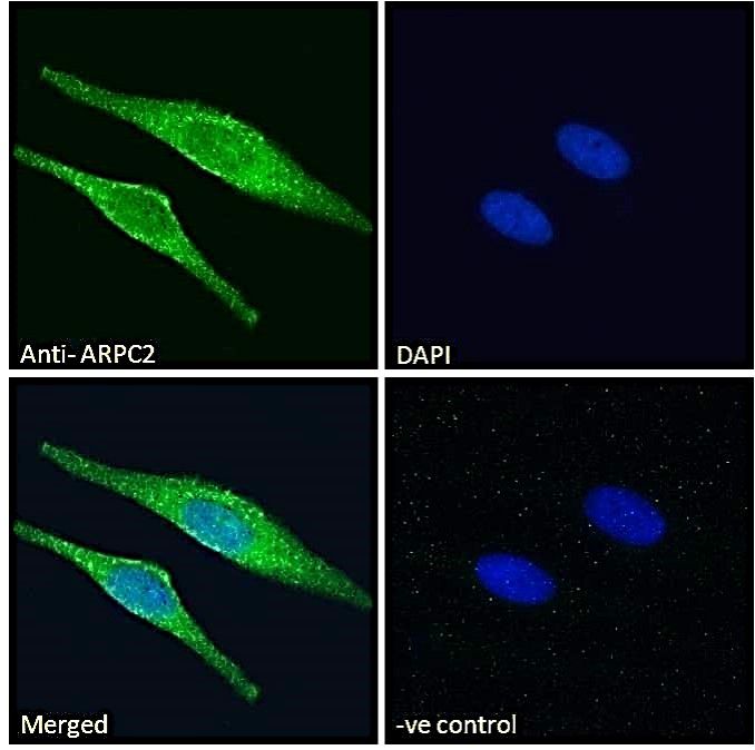 Goat anti-ARPC2 Antibody