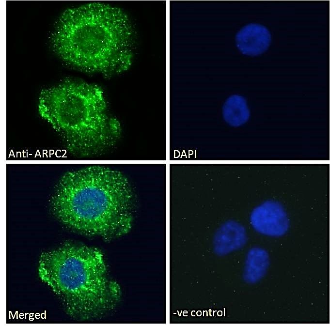 Goat anti-ARPC2 Antibody