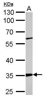 ARPC2 antibody