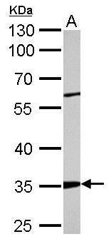 actin related protein 2/3 complex subunit 2 Antibody