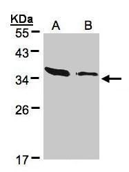 actin related protein 2/3 complex subunit 2 Antibody