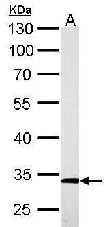 actin related protein 2/3 complex subunit 2 Antibody