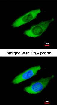 ARPC2 antibody