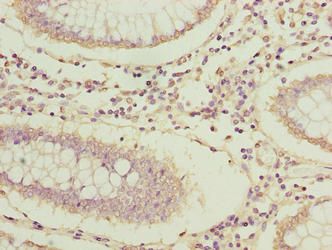 ARPIN Antibody