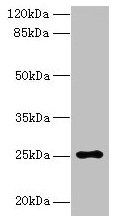 ARPIN antibody