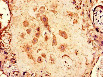 ARPP19 Antibody