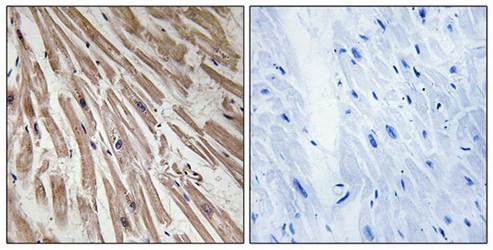ARPP21 Antibody