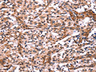 ARRB1 Antibody