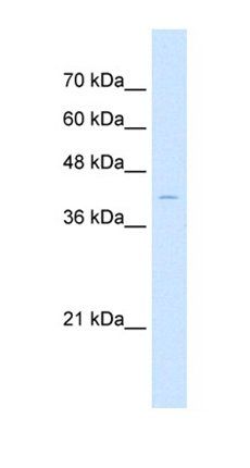 ARRB2 antibody