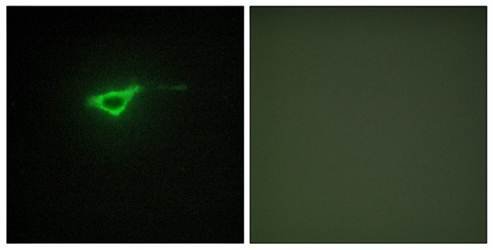 Collagen XX α1 Antibody