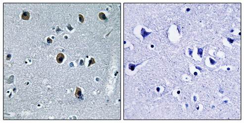 ARRDC3 antibody