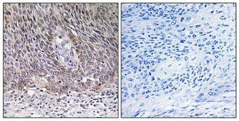 ARSA Antibody
