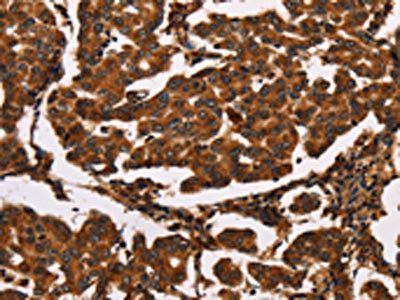 ARSB Antibody