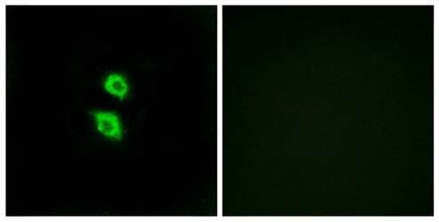 ARSD antibody