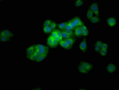ARSE Antibody