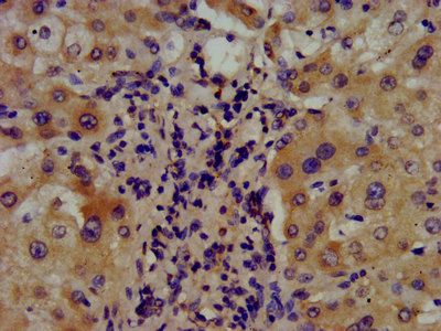 ARSE Antibody