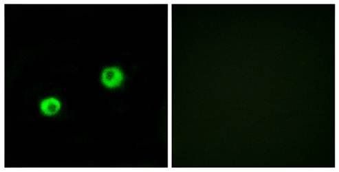 ARSI Antibody