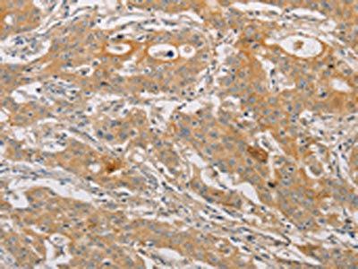 ARSK Antibody