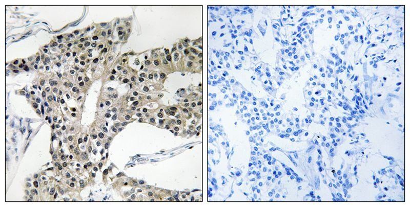 ARSK Rabbit Polyclonal Antibody
