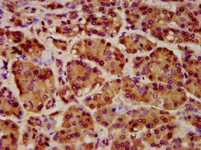 ART5 Antibody