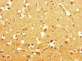 ART5 Antibody