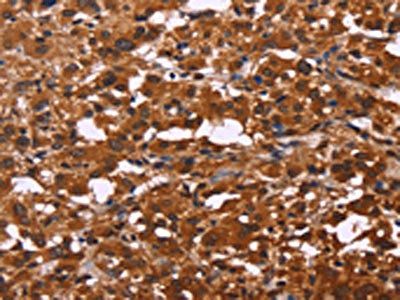 ART5 Antibody