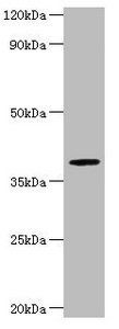 ARSB Antibody