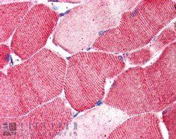 Goat anti-Arylsulfatase B Antibody