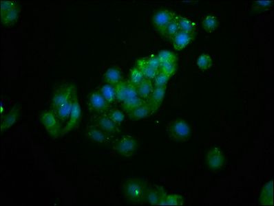 AS3MT Antibody