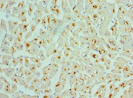ASAH1 Antibody