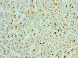 ASAH1 antibody