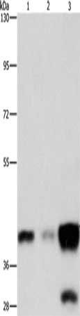 ASAH1 Antibody