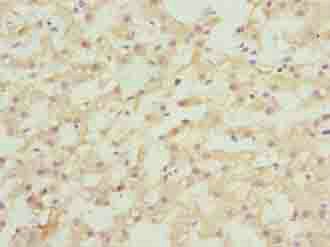 ASAP3 Antibody