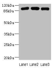 ASAP3 Antibody