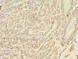 ASB11 antibody