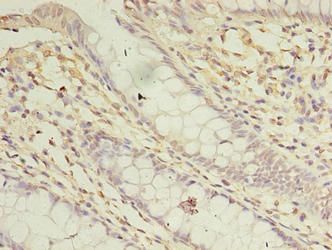 ASB8 Antibody