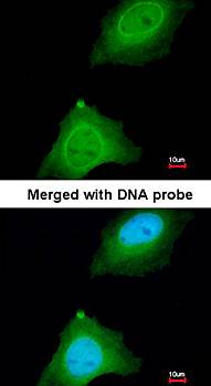 ASB9 antibody