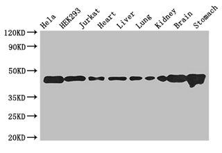 ASCC1 antibody