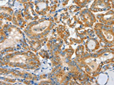 ASCC1 antibody