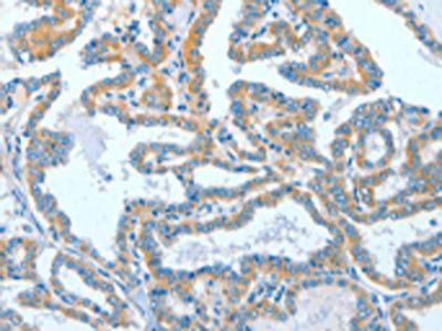 ASCC1 antibody