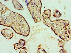 ASCC3 Antibody