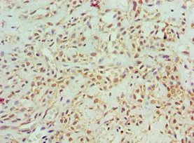 ASCC3 Antibody