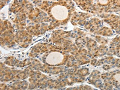ASCL1 Antibody