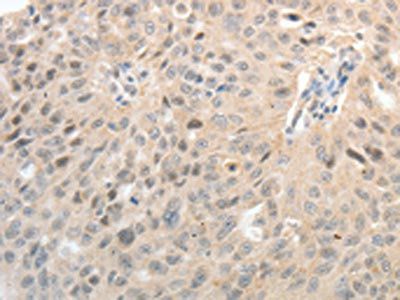 ASCL1 Antibody